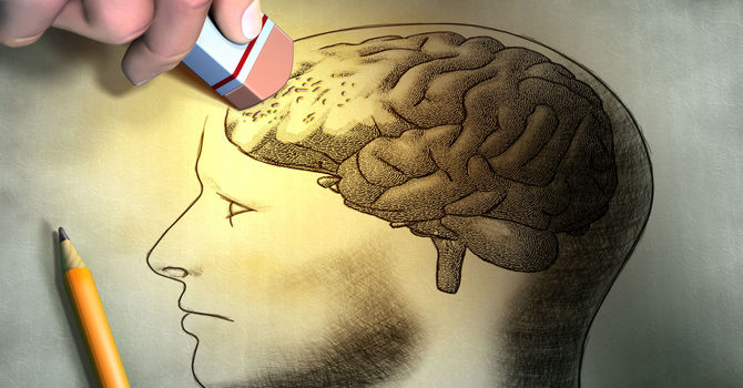 Excessive Daytime Napping Can Be An Early Sign of Alzheimer’s Disease